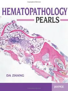 Hematopathology Pearls