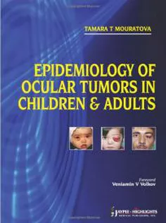 Epidemiology of Ocular Tumors in Children and Adults