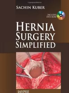 Hernia Surgery Simplified