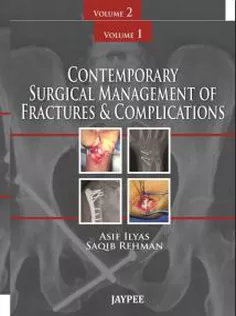 Contemporary Surgical Management of Fractures and Complications