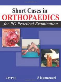 Short Cases in Orthopaedics For PG Practical Examination