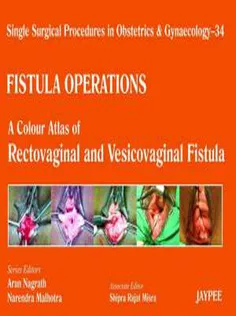 Single Surgical Procedures in Obstetrics and Gynaecology: Fistula Operations - A Colour Atlas of Rectovaginal and Vesico