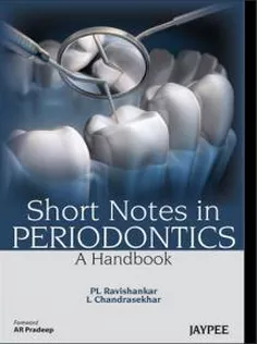 Short Notes in Periodontics : A Handbook