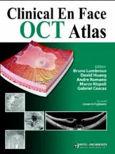Clinical En Face Oct Atlas
