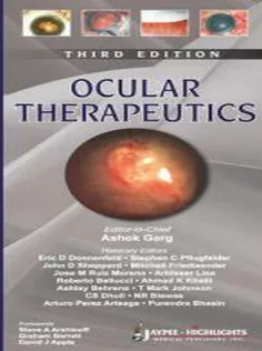 Ocular Therapeutics