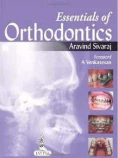 Essentials of Orthodontics