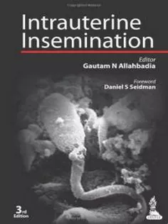 Intrauterine Insemination