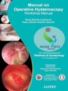 Manual On Operative Hysteroscopy