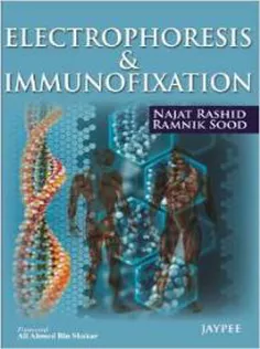 Electrophoresis & Immunofixation