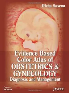 Evidence Based Color Atlas Of Obstetrics & Gynecology