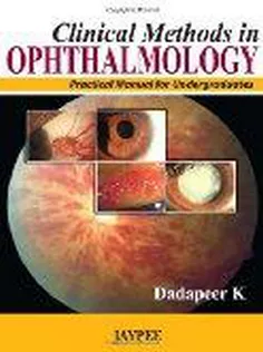 Clinical Methods In Ophthalmology