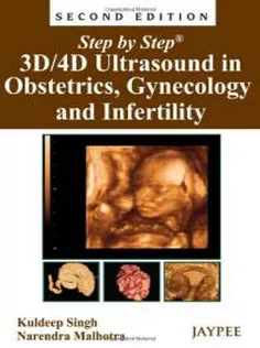 Step by Step 3D/4D Ultrasound in Obstetrics,Gynecology and Infertility