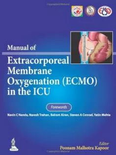 Manual of Extracorporeal Membrane Oxygenation (ECMO) in the ICU