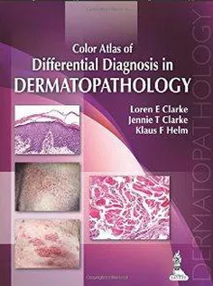 9789350908457 Color Atlas Of Differential Diagnosis In Dermatopatholoy