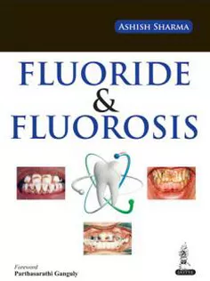 Fluoride and Fluorosis