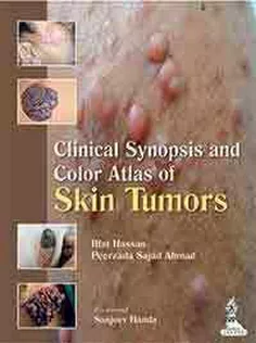 9789350909454 Clinical Synopsis and Color Atlas of Skin Tumors
