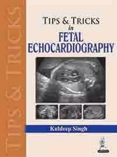 Tips and Tricks in Fetal Echocardiography