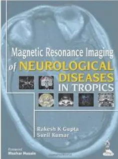 Magnetic Resonance Imaging of Neurological Diseases in Tropics