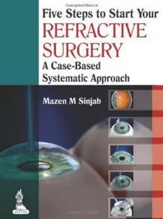 Five Steps to Start Your Refractive Surgery