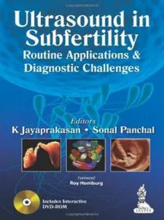 Ultrasound in Subfertility: Routine Applications and Diagnostic Challenges1