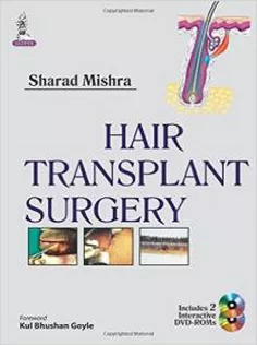 Hair Transplant Surgery