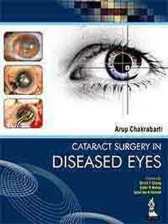 Cataract Surgery in Diseased Eyes