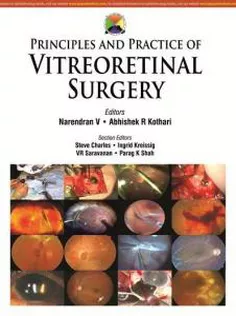 Principles and Practice of Vitreoretinal Surgery