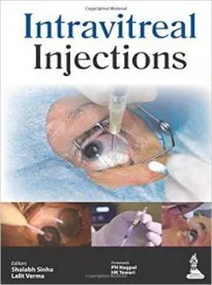 Intravitreal Injections