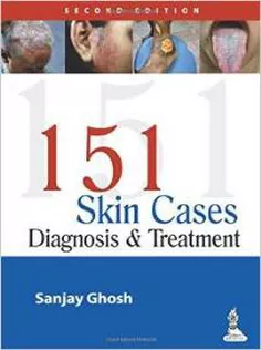151 Skin Cases: Diagnosis and Treatment
