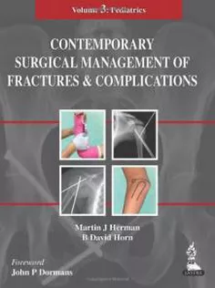 Contemporary Surgical Management of Fractures and Complications: Pediatrics
