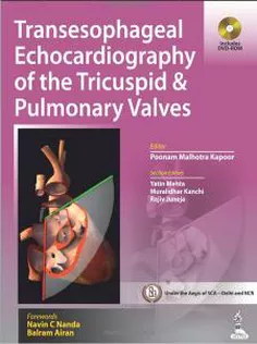 Transesophageal Echocardiography of the Tricuspid and Pulmonary Valves
