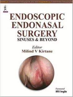 Endonasal Endoscopic Surgery Sinuses & Beyond