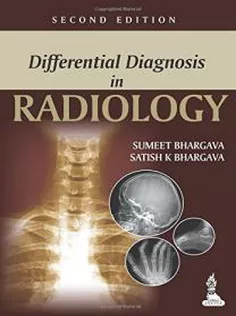 Differential Diagnosis In Radiology
