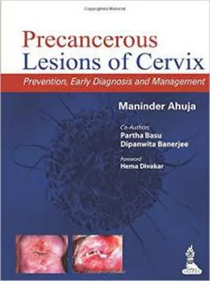 Precancerous Lesions of Cervix:Prevention,Early Diagnosis and Management