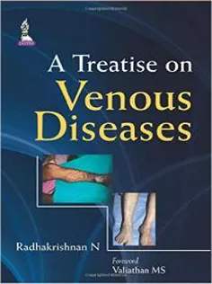 A Treatise on Venous Diseases