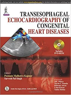 Transesophageal Echocardiography of Congenital Heart Diseases