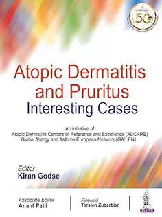 Atopic Dermatitis and Pruritus Interesting Cases