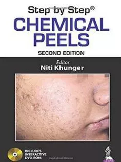 Step by Step Chemical Peels