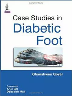 Case Studies in Diabetic Foot