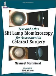 Text and Atlas Slit Lamp Biomicroscopy for Assessment in Cataract Surgery