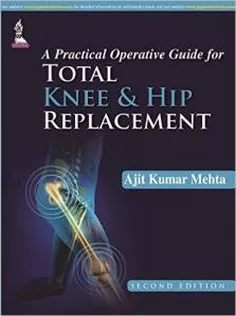 A Practical Operative Guide for Total Knee and Hip Replacement