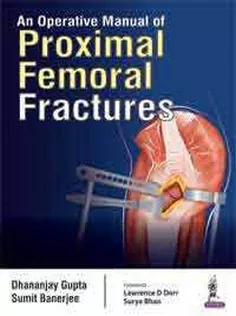 An Operative Manual of Proximal Femoral Fractures