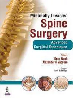 Minimally Invasive Spine Surgery: Advanced Surgical Techniques