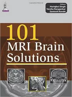 101 MRI Brain Solutions