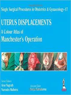 Uterus Displacements: A Colour Atlas of Manchester's Operation