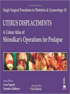 Uterus: Displacements: A Colour Atlas of Shirodkar's Operations for Prolapse