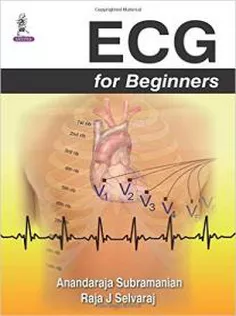 ECG for Beginners