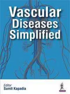 Vascular Diseases Simplified