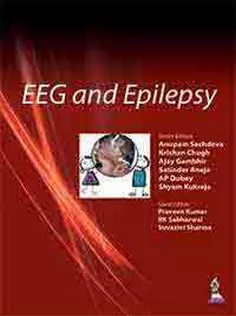 PEDICON WORKSHOP MANUALS-2015(IAP) EEG AND EPILEPSY