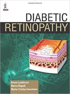 Diabetic Retinopathy